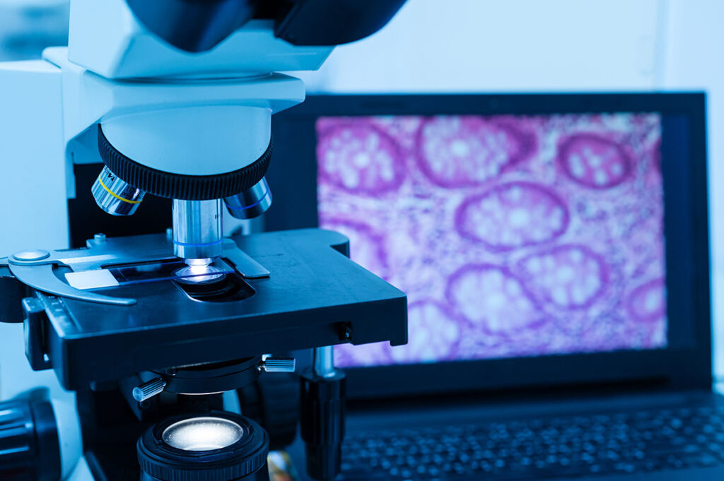 cancer cell research under microscope